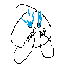 케장콘 5